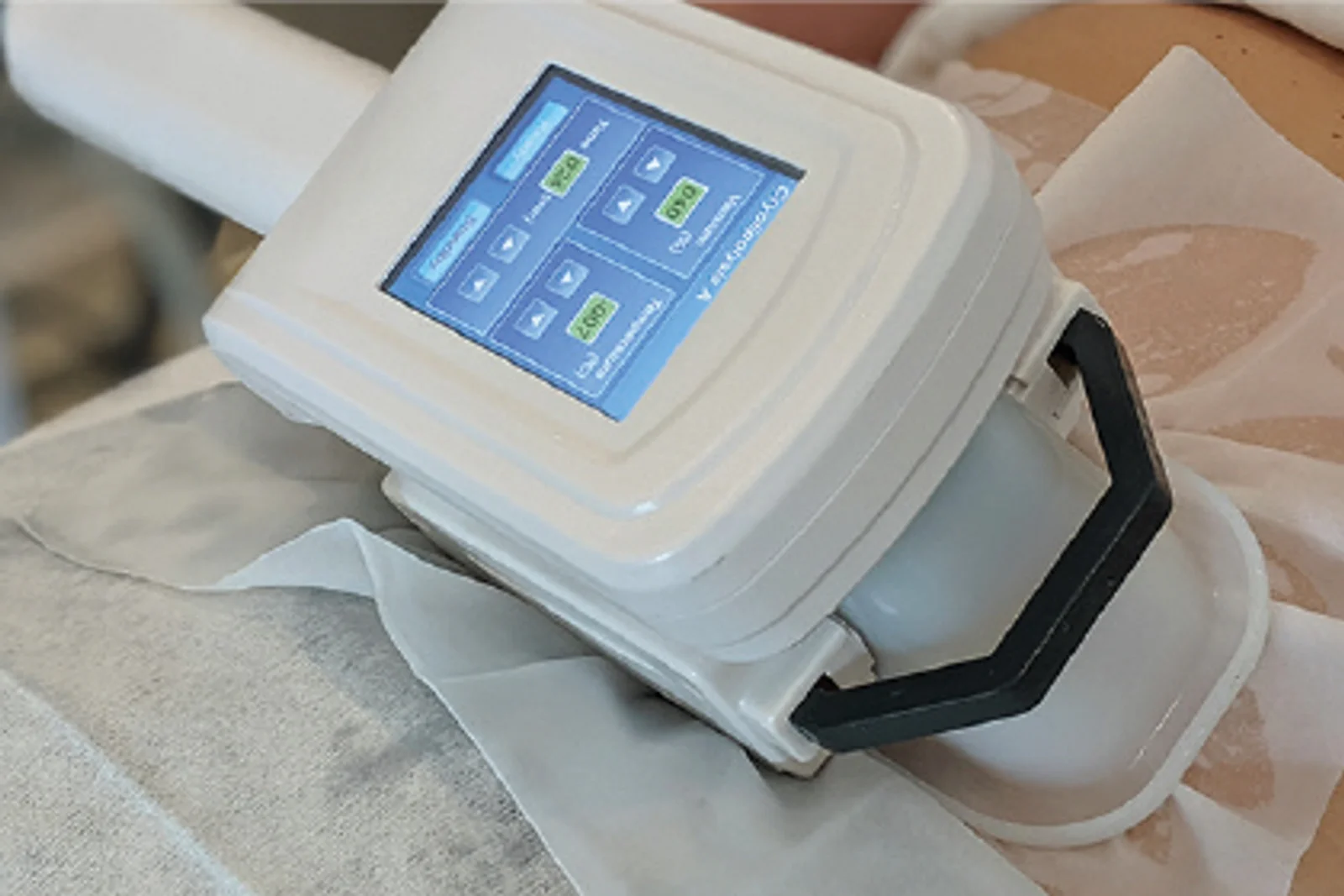 Cryolipolysis Fat Freeze Treatment (One Cup)
