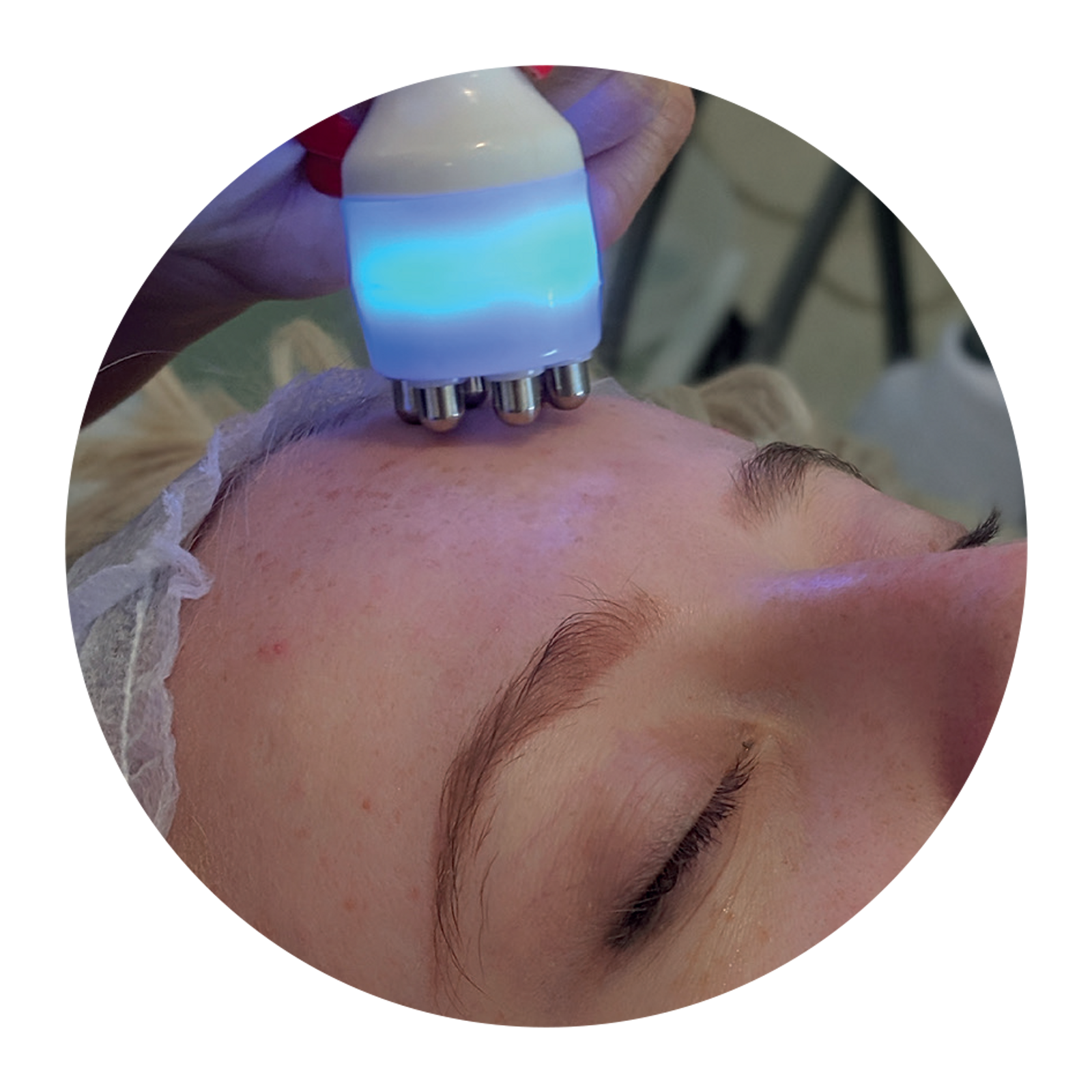 3D-Hydrofacial-Images-5.png