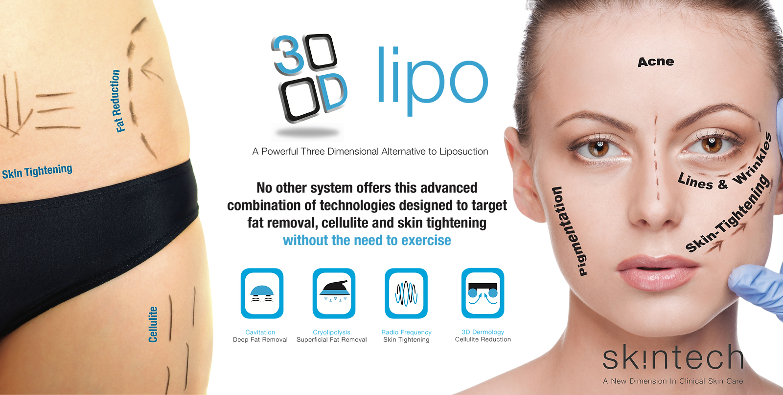 3D-Lipo-A3-Canvas-2a.png