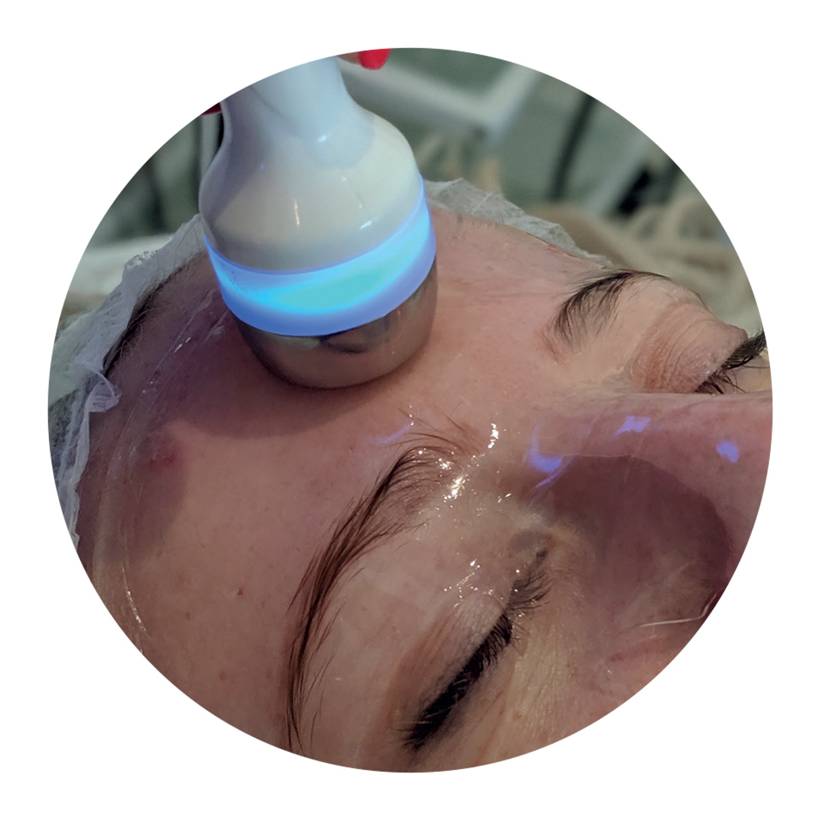 3D-Hydrofacial-Images-6.png