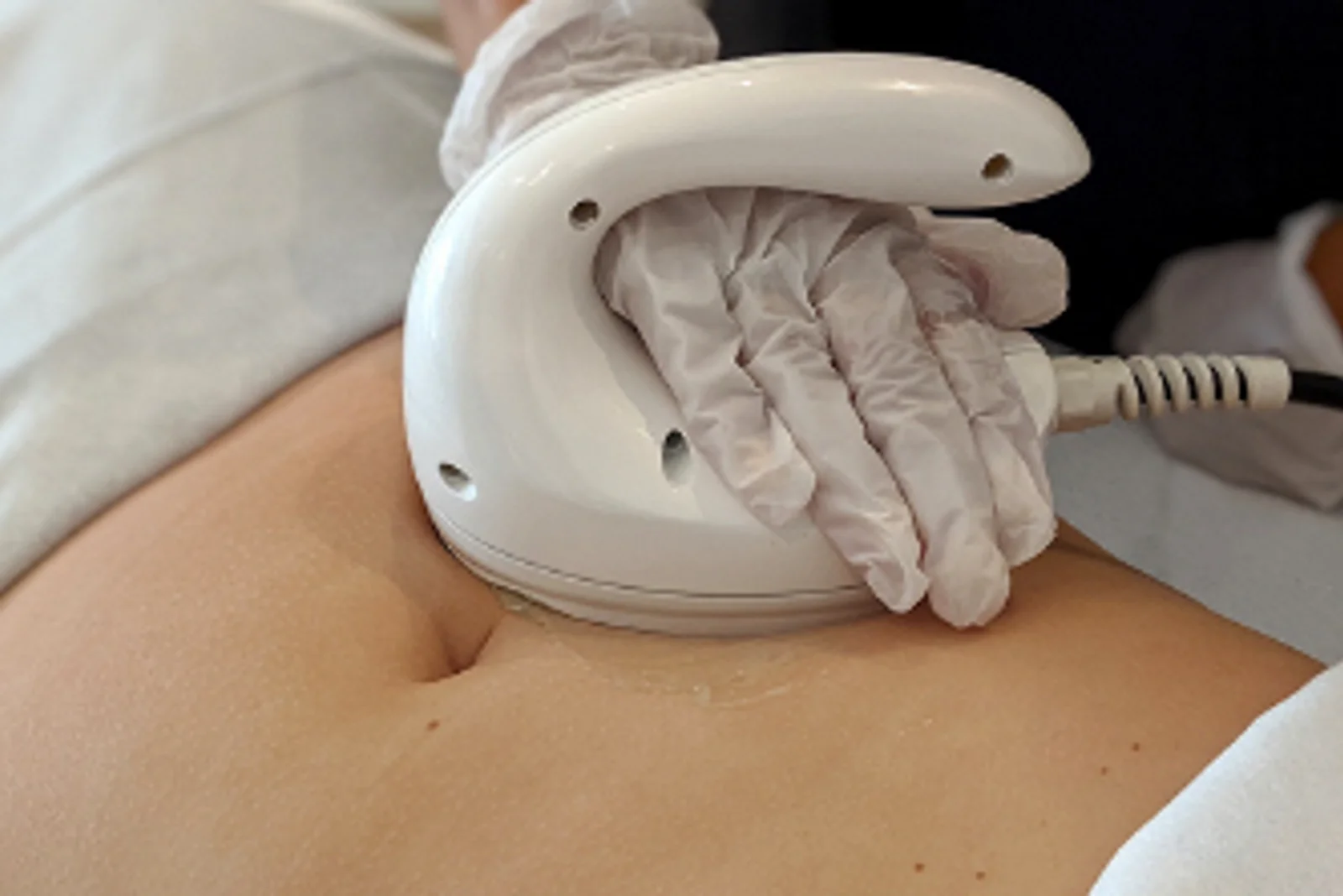Cavitation Instant Inch Loss