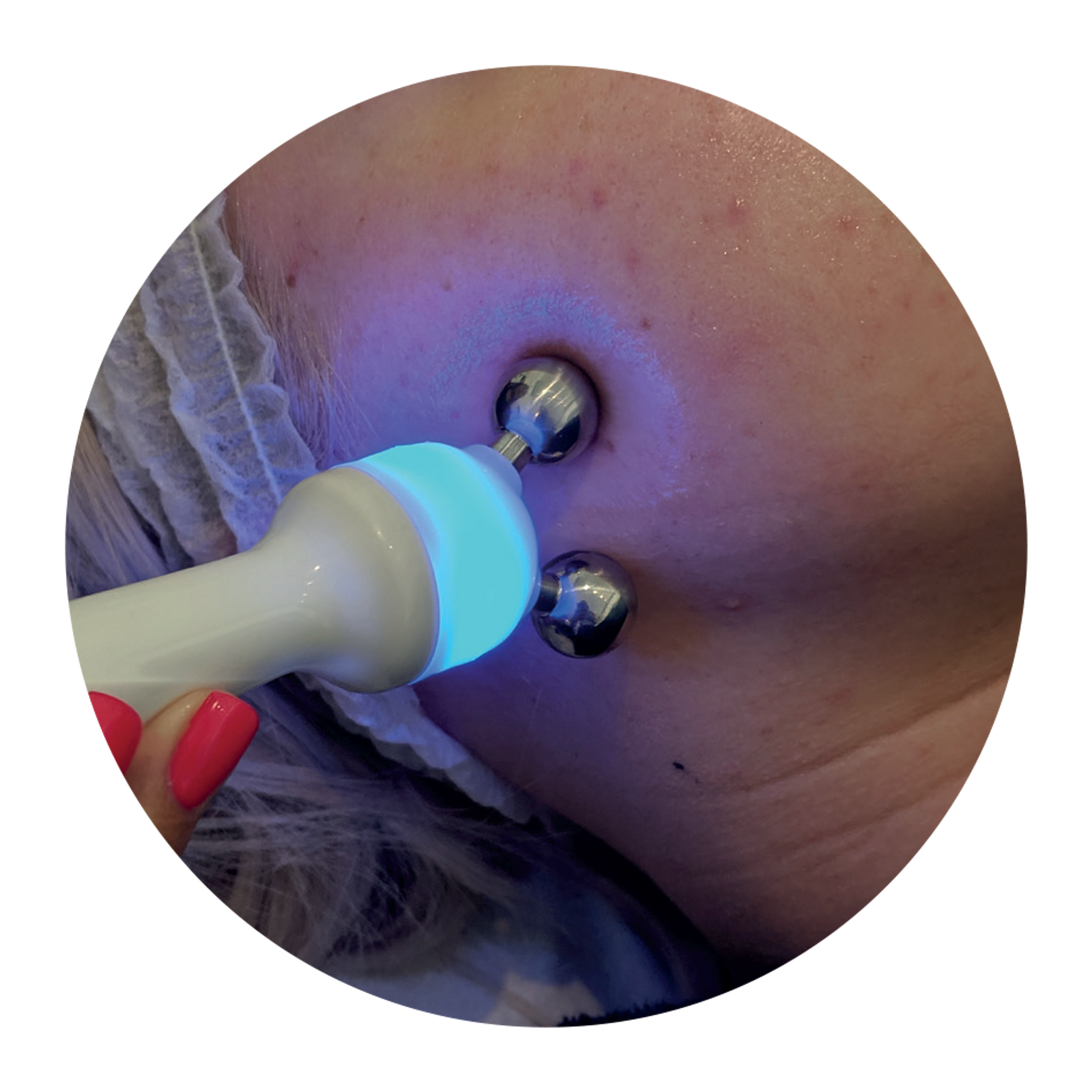 3D-Hydrofacial-Images-4.png